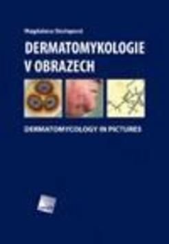 Dermatomykologie v obrazech