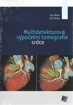 Multidetektorová výpočetní tomografie srdce