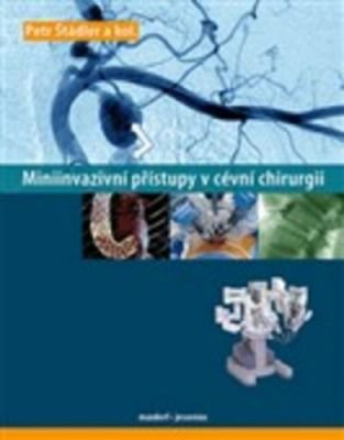 Miniinvazivní přístupy v cévní chirurgií - Petr Štádler