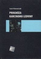 Kawaciuk Ivan Prognóza karcinomu ledviny