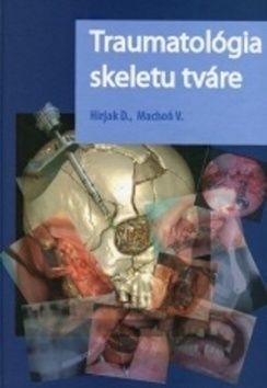 Traumatológia skeletu tváre - Vladimír Machoň, Dušan Hirjak