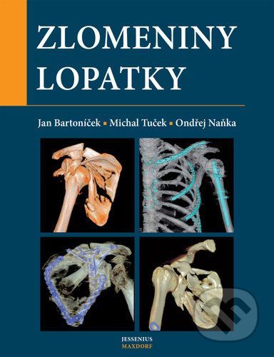 Zlomeniny lopatky - Jan Bartoníček, Michal Tuček, Ondřej Naňka