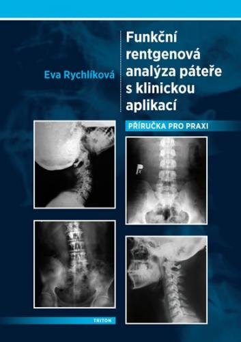 Rychlíková Eva: Funkční rentgenová analýza páteře s klinickou aplikací