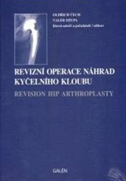 Revizní operace náhrad kyčelního kloubu - Valér Džupa, Oldřich Čech