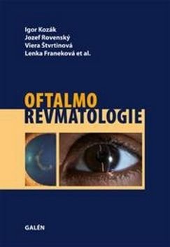 Oftalmorevmatologie - Jozef Rovenský, Lenka Franeková, Viera Štvrtinová, Igor Kozák