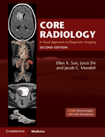 Core Radiology - A Visual Approach to Diagnostic Imaging(Paperback / softback)