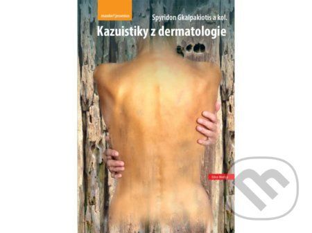 Kazuistiky z dermatologie - Spyridon Gkalpakiotis