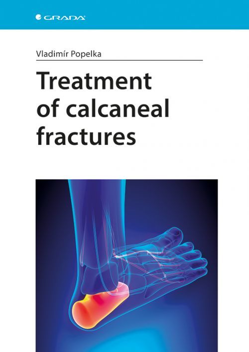 Treatment of Calcaneal Fractures - Popelka Vladimír
