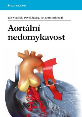 Aortální nedomykavost - Jan Dominik, Pavel Žáček, kolektiv a, Jan Vojáček - e-kniha