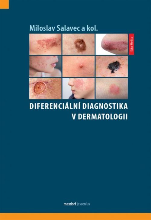 Diferenciální diagnostika v dermatologii - Salavec Miloslav, Vázaná
