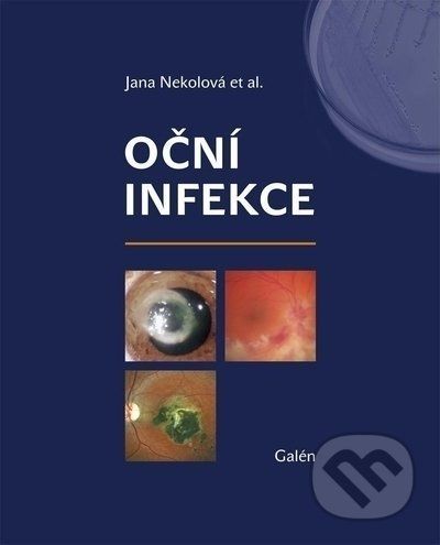 Oční infekce - Jana Nekolová