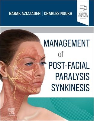 Management of Post-Facial Paralysis Synkinesis(Pevná vazba)