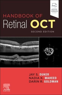 Handbook of Retinal OCT: Optical Coherence Tomography (Duker Jay S. MD (Director New England Eye Center Chairman and Professor of Ophthalmology Tufts Medical Center Tufts University School of Medicine Boston Massachusetts))(Paperback / softback)