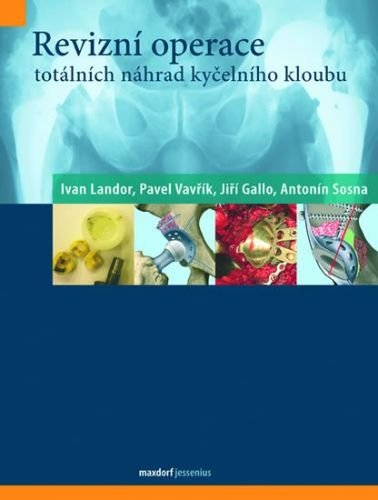 kolektiv autorů: Revizní operace totálních náhrad kyčelního kloubu