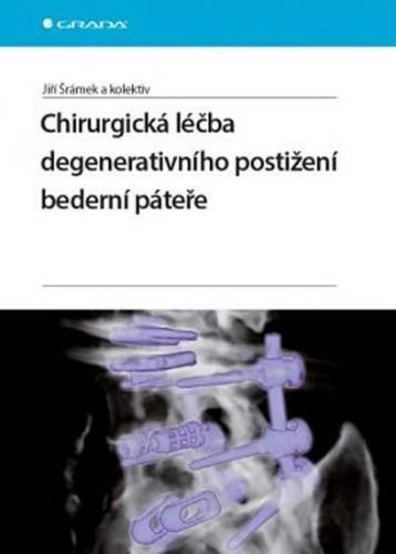 Šrámek Jiří a kolektiv: Chirurgická léčba degenerativního postižení bederní páteře