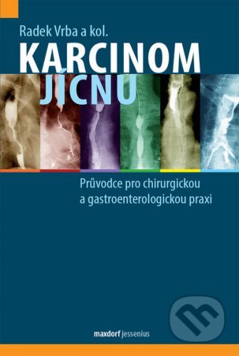 Karcinom jícnu - Radek Vrba , kolektív autorů