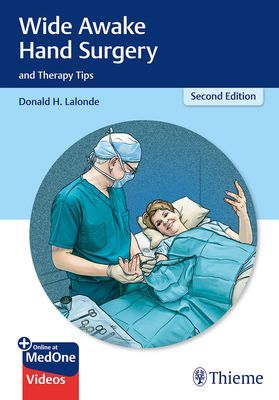 Wide Awake Hand Surgery and Therapy Tips (Lalonde Donald)(Paperback / softback)