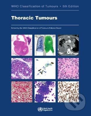 WHO Classification of Tumours: Thoracic Tumours - World Health Organization