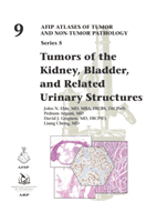 Tumors of the Kidney, Bladder, and Related Urinary Structures (Eble John)(Pevná vazba)