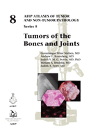 Tumors of the Bones and Joints (Nielsen Gunnlaugur Petur)(Pevná vazba)