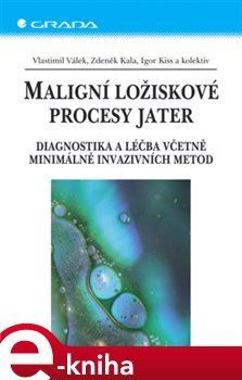 Maligní ložiskové procesy jater - Vlastimil Válek, Zdeněk Kala, Igor Kiss