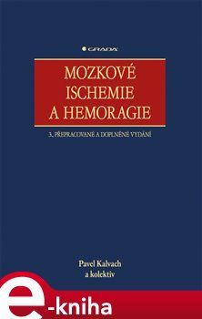 Mozkové ischemie a hemoragie - Pavel Kalvach