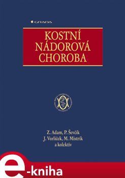 Kostní nádorová choroba - Zdeněk Adam, Pavel Ševčík, Jiří Vorlíček, Martin Mistrík