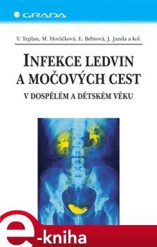 Infekce ledvin a močových cest - Vladimír Teplan, Miroslava Horáčková, Jan Janda