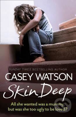 Skin Deep - Casey Watson