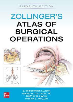 Zollinger's Atlas of Surgical Operations, Eleventh Edition (Pawlik Timothy)(Pevná vazba)