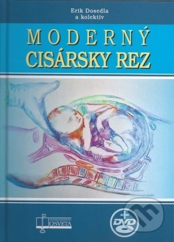 Moderný cisársky rez - Erik Dosedla, kolektív autorov