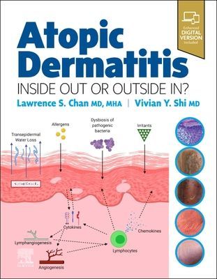Atopic Dermatitis: Inside Out or Outside In(Pevná vazba)