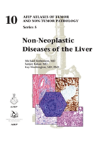 Non-Neoplastic Diseases of the Liver (Torbenson Michael MD)(Pevná vazba)