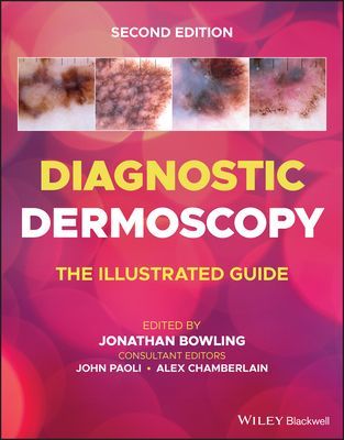 Diagnostic Dermoscopy - The Illustrated Guide, 2e (Bowling J)(Paperback / softback)