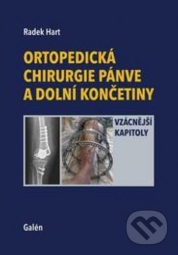 Ortopedická chirurgie pánve a dolní končetiny - Radek Hart