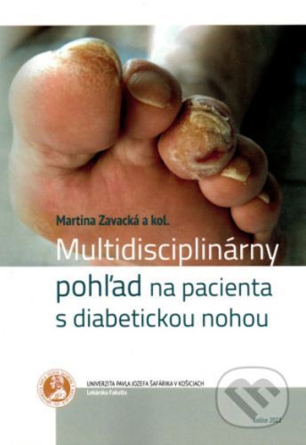 Multidisciplinárny pohľad na pacienta s diabetickou nohou - Martina Zavacka