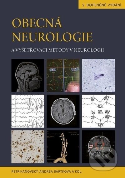 Obecná neurologie a vyšetřovací metody v neurologii - Petr Kaňovský, Andrea Bártková