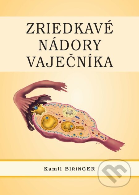 Zriedkavé nádory vaječníka - Kamil Biringer