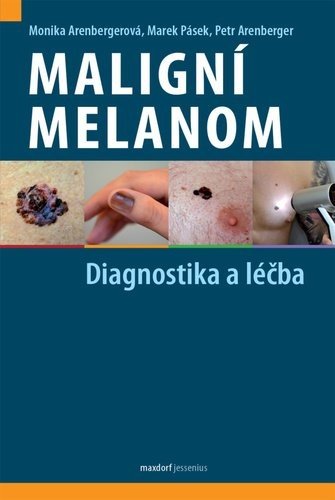 Maligní melanom - Diagnostika a léčba - Monika Arenbergerová; Marek Pásek; Petr Arenberger