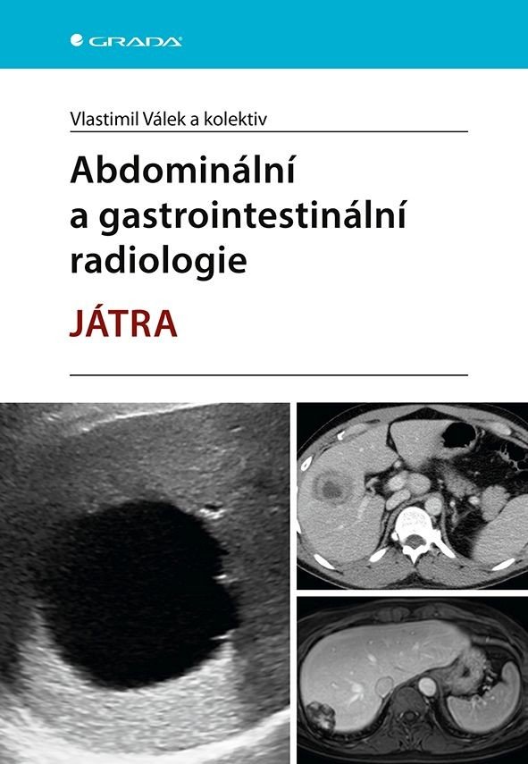 Abdominální a gastrointestinální radiologie - Játra, Válek Vlastimil