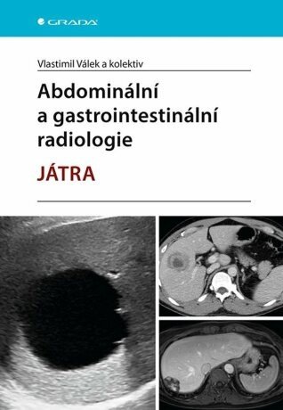 Abdominální a gastrointestinální radiologie - e-kniha