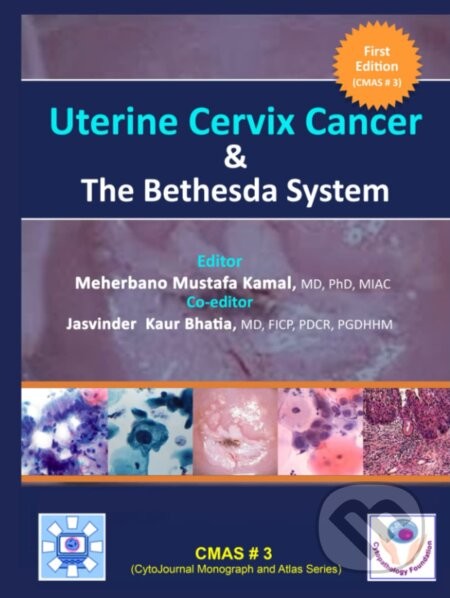 Uterine Cervix Cancer The Bethesda System - Meherbano Mustafa Kamal