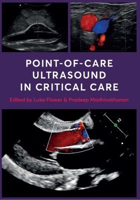Point-of-Care Ultrasound in Critical Care(Paperback / softback)