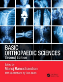 Basic Orthopaedic Sciences (Ramachandran Manoj)(Paperback)