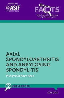 Ankylosing Spondylitis and Axial Spondyloarthritis (Khan Muhammad Asim)(Paperback)