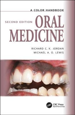 Oral Medicine (Lewis Michael)(Paperback)