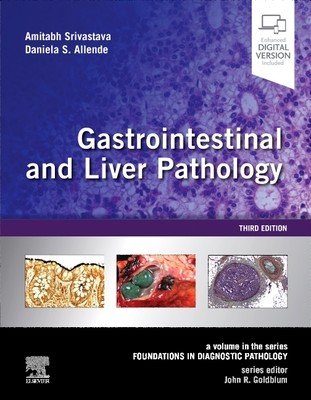 Gastrointestinal and Liver Pathology: A Volume in the Series: Foundations in Diagnostic Pathology (Srivastava Amitabh)(Pevná vazba)