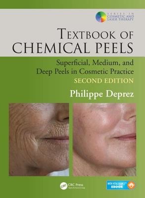 Textbook of Chemical Peels: Superficial, Medium, and Deep Peels in Cosmetic Practice (Deprez Philippe)(Pevná vazba)
