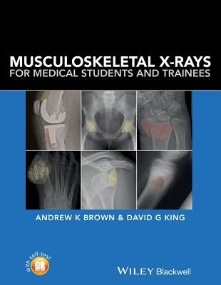 Musculoskeletal X-Rays for Medical Students and Trainees (Brown Andrew)(Paperback)