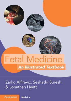 Fetal Medicine: An Illustrated Textbook (Alfirevic Zarko)(Paperback)